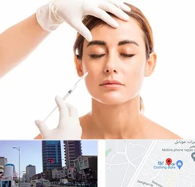 تزریق ژل گونه در چهارراه طالقانی کرج