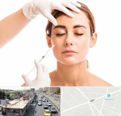 تزریق ژل گونه در خیابان دماوند