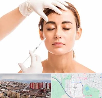 تزریق ژل گونه در سهند تبریز