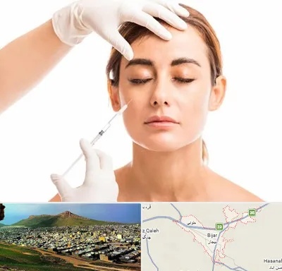 تزریق ژل گونه در بیجار