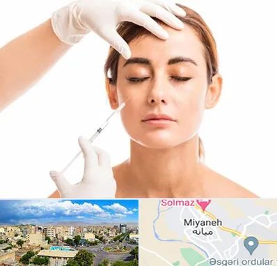 تزریق ژل گونه در میانه