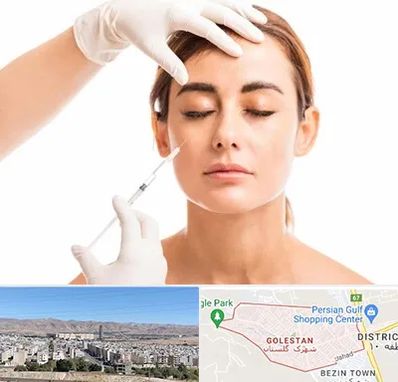 تزریق ژل گونه در شهرک گلستان شیراز