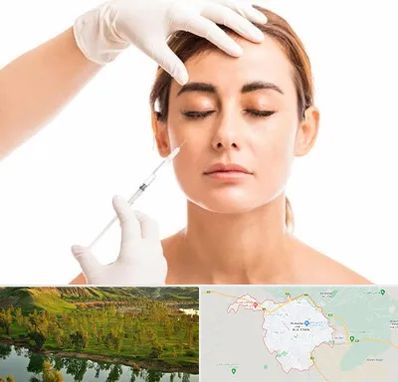 تزریق ژل گونه در بهبهان