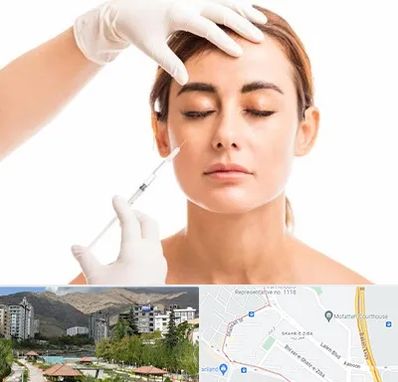 تزریق ژل گونه در شهر زیبا