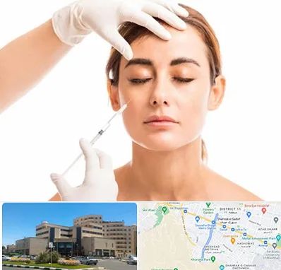 تزریق ژل گونه در صیاد شیرازی مشهد