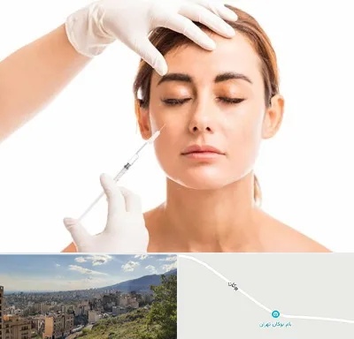 تزریق ژل گونه در بوکان تهران