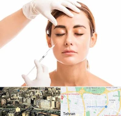 تزریق ژل گونه در مرزداران