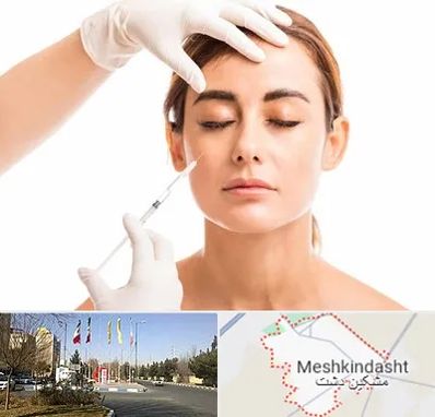 تزریق ژل گونه در مشکین دشت