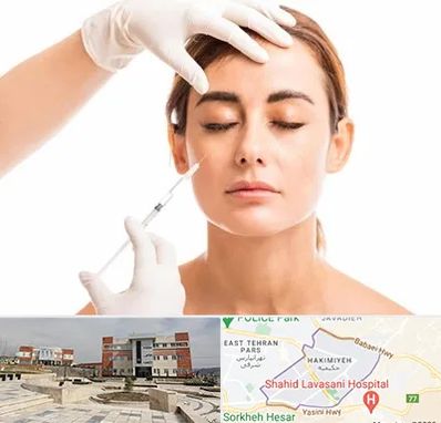 تزریق ژل گونه در حکیمیه