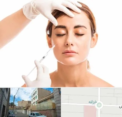 تزریق ژل گونه در خزانه