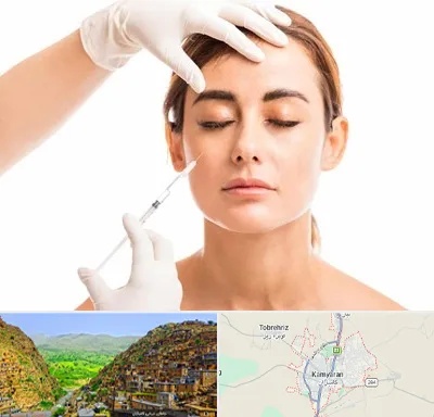 تزریق ژل گونه در کامیاران