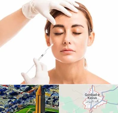تزریق ژل گونه در گنبد کاووس