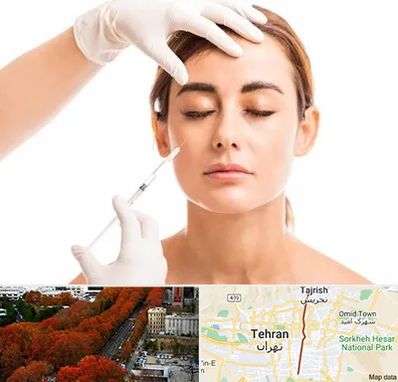 تزریق ژل گونه در ولیعصر