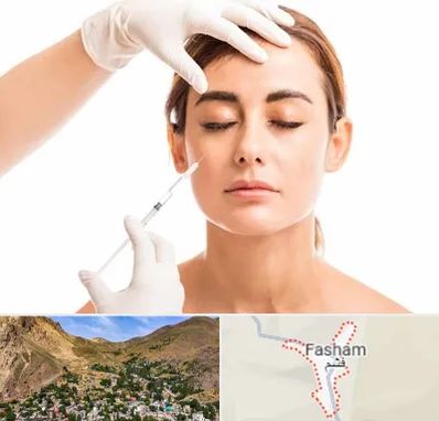 تزریق ژل گونه در فشم