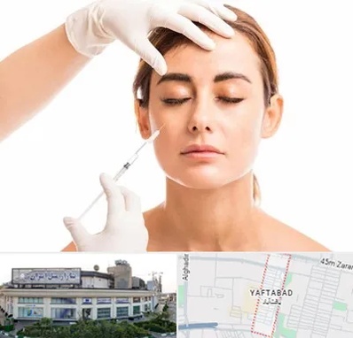 تزریق ژل گونه در یافت آباد