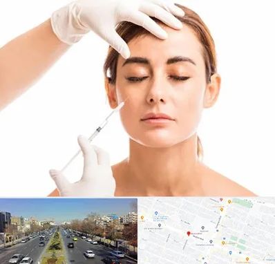 تزریق ژل گونه در بلوار معلم مشهد