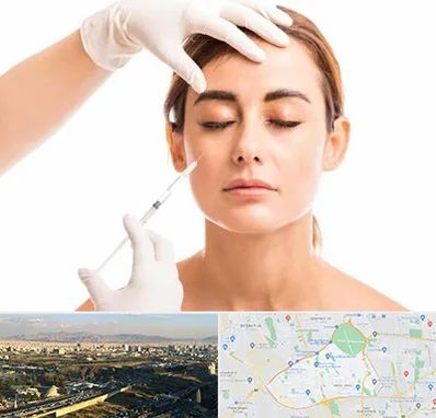 تزریق ژل گونه در منطقه 19 تهران