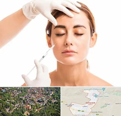 تزریق ژل گونه در دماوند