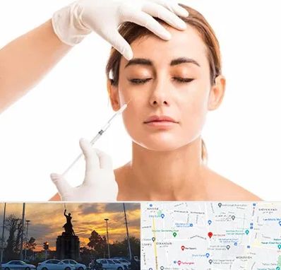 تزریق ژل گونه در میدان حر