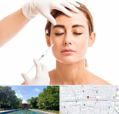 تزریق ژل گونه در هشت بهشت اصفهان