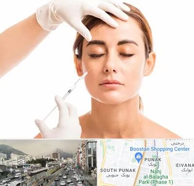 تزریق ژل گونه در پونک