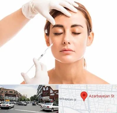 تزریق ژل گونه در خیابان آذربایجان