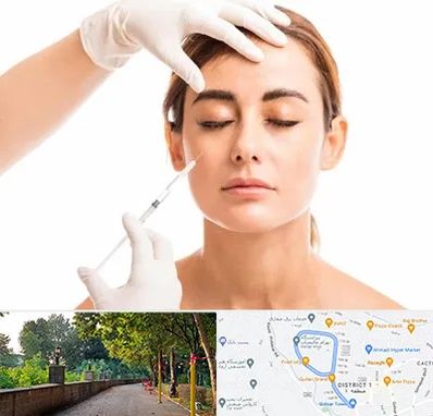 تزریق ژل گونه در بلوار گیلان رشت