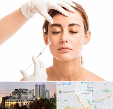 تزریق ژل گونه در فرشته