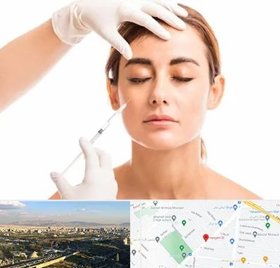 تزریق ژل گونه در هنگام