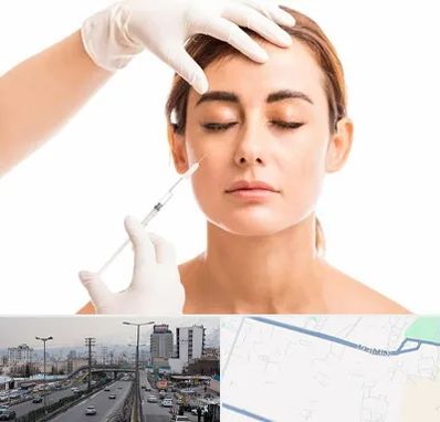 تزریق ژل گونه در بلوار ارتش