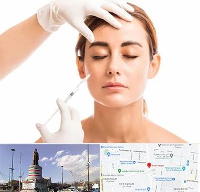 تزریق ژل گونه در کارگر جنوبی