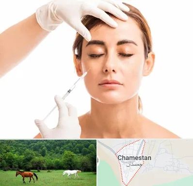 تزریق ژل گونه در چمستان