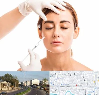 تزریق ژل گونه در ضیابری رشت