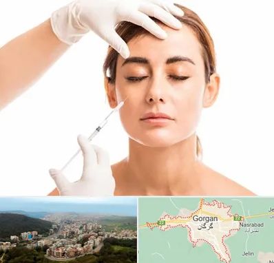 تزریق ژل گونه در گرگان