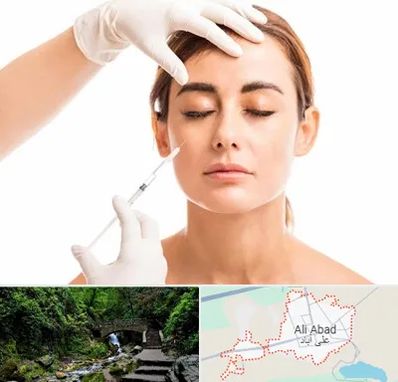 تزریق ژل گونه در علی آباد کتول