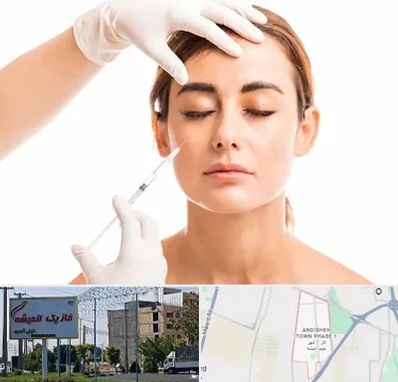تزریق ژل گونه در فاز یک اندیشه