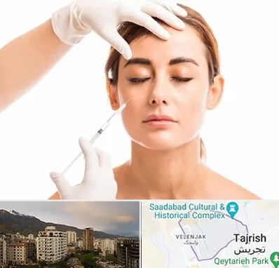 تزریق ژل گونه در زعفرانیه