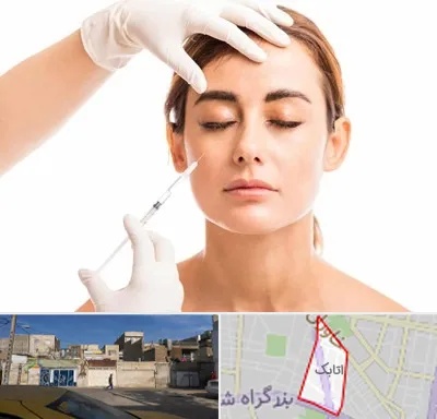 تزریق ژل گونه در اتابک