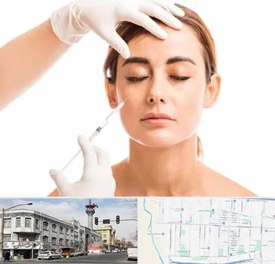 تزریق ژل گونه در 17شهریور