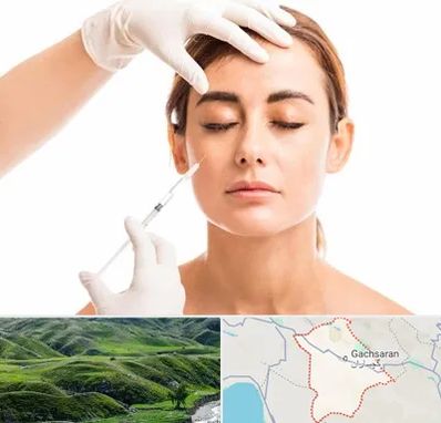 تزریق ژل گونه در گچساران