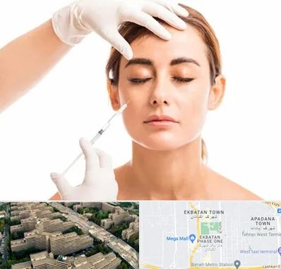 تزریق ژل گونه در اکباتان