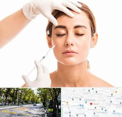 تزریق ژل گونه در میرداماد