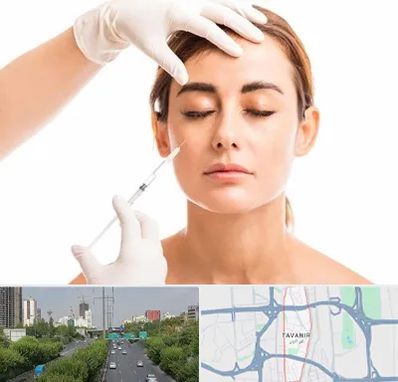 تزریق ژل گونه در توانیر