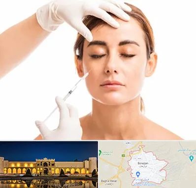 تزریق ژل گونه در برازجان