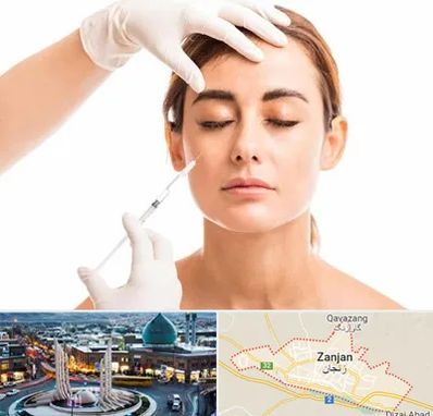 تزریق ژل گونه در زنجان