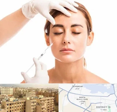 تزریق ژل گونه در جنوب غرب تهران