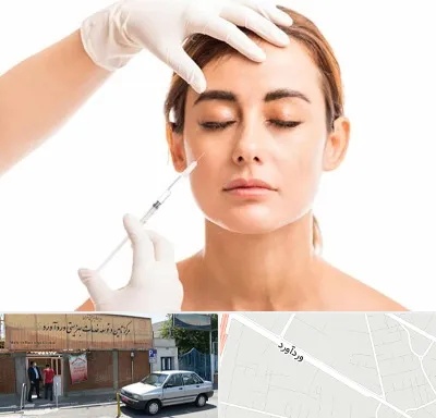 تزریق ژل گونه در وردآورد