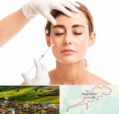 تزریق ژل گونه در کلاردشت