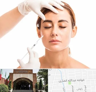 تزریق ژل گونه در خواجه عبدالله