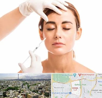 تزریق ژل گونه در گیشا